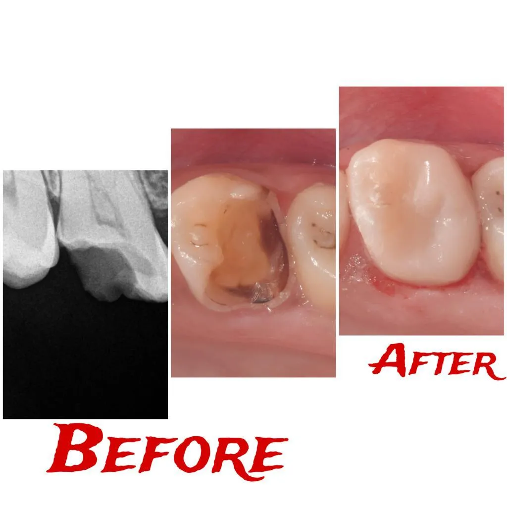 Pediatric Dentistry for Kids Guntur