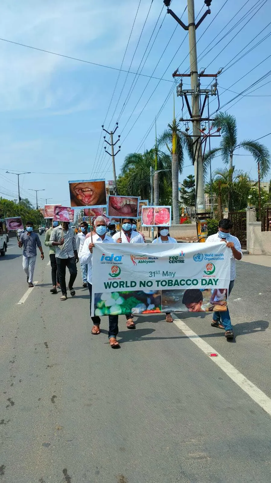 Myla Dental Care staff marching in World No Tobacco Day public oral cancer awareness rally in Guntur